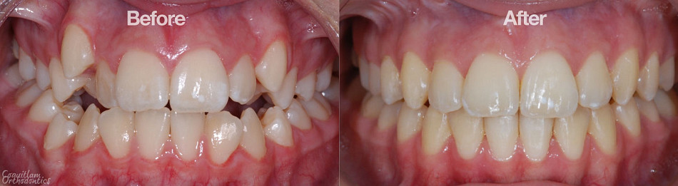 Teeth