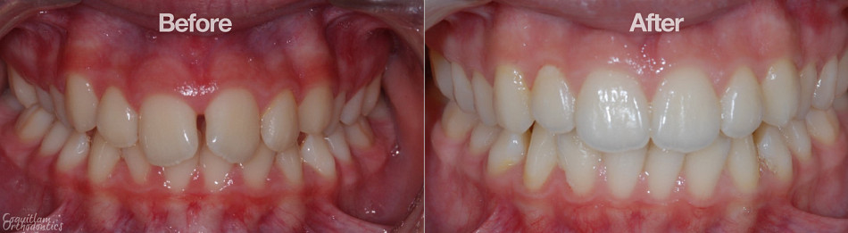 Teeth