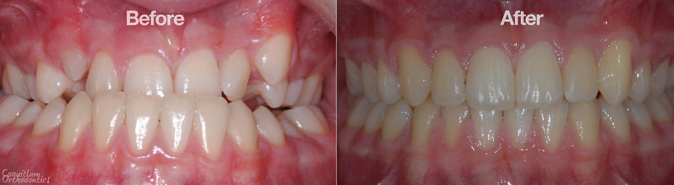 Teeth