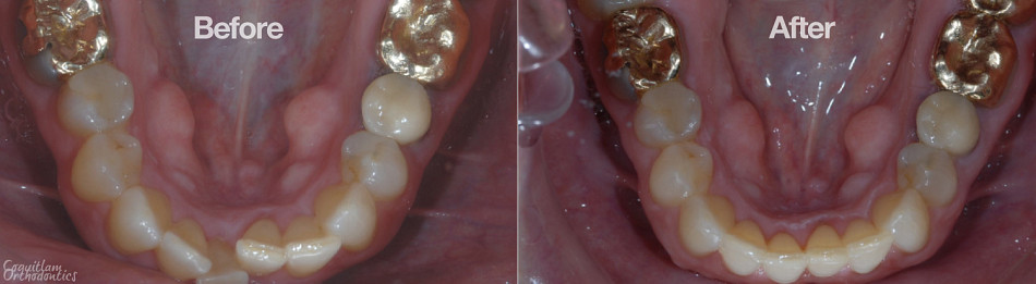 Teeth