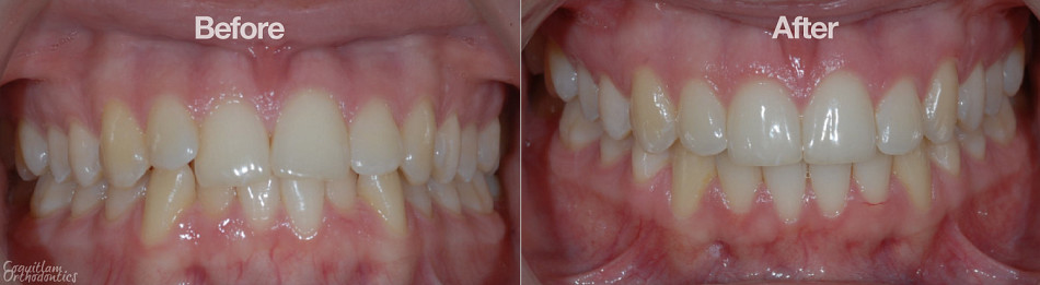 Teeth