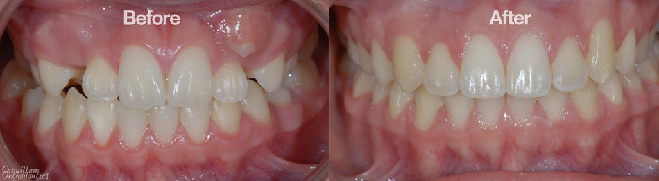 Teeth