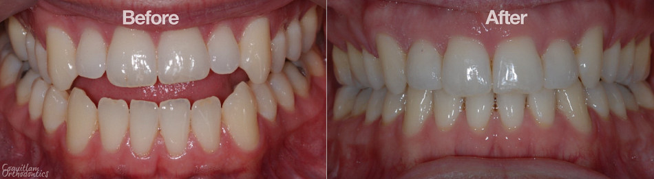 Teeth