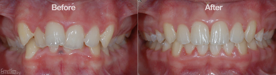 Teeth