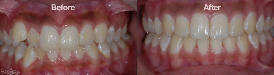 Teeth
