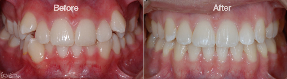 Teeth