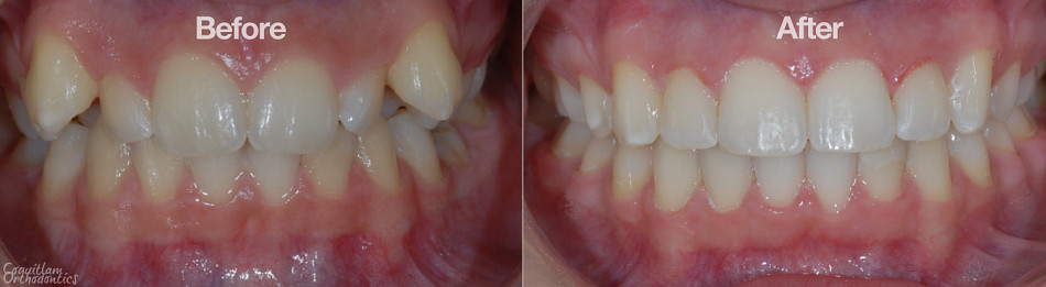 Teeth