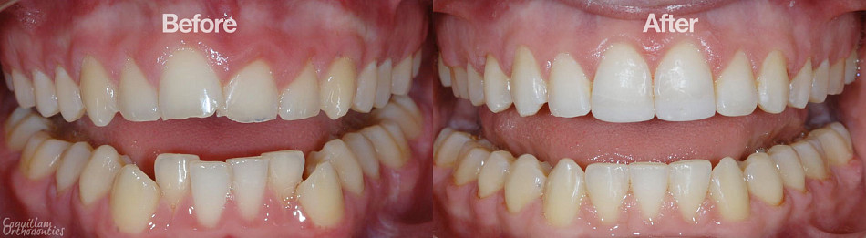Teeth
